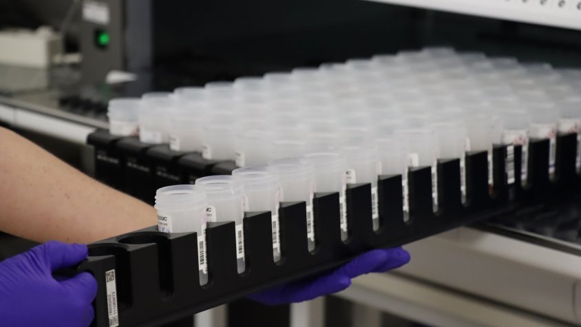 El nou cribratge de càncer de coll uterí detecta el virus del papil·loma humà a 3.691 dones de les comarques gironines