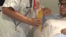 L’Hospital d’Olot i Comarcal de la Garrotxa comença a provar fèrules 3D per a fractures de radi distal